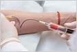 O que pode alterar o resultado do exame de sangue Confira 5